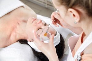 Ưu điểm của phương pháp peel da